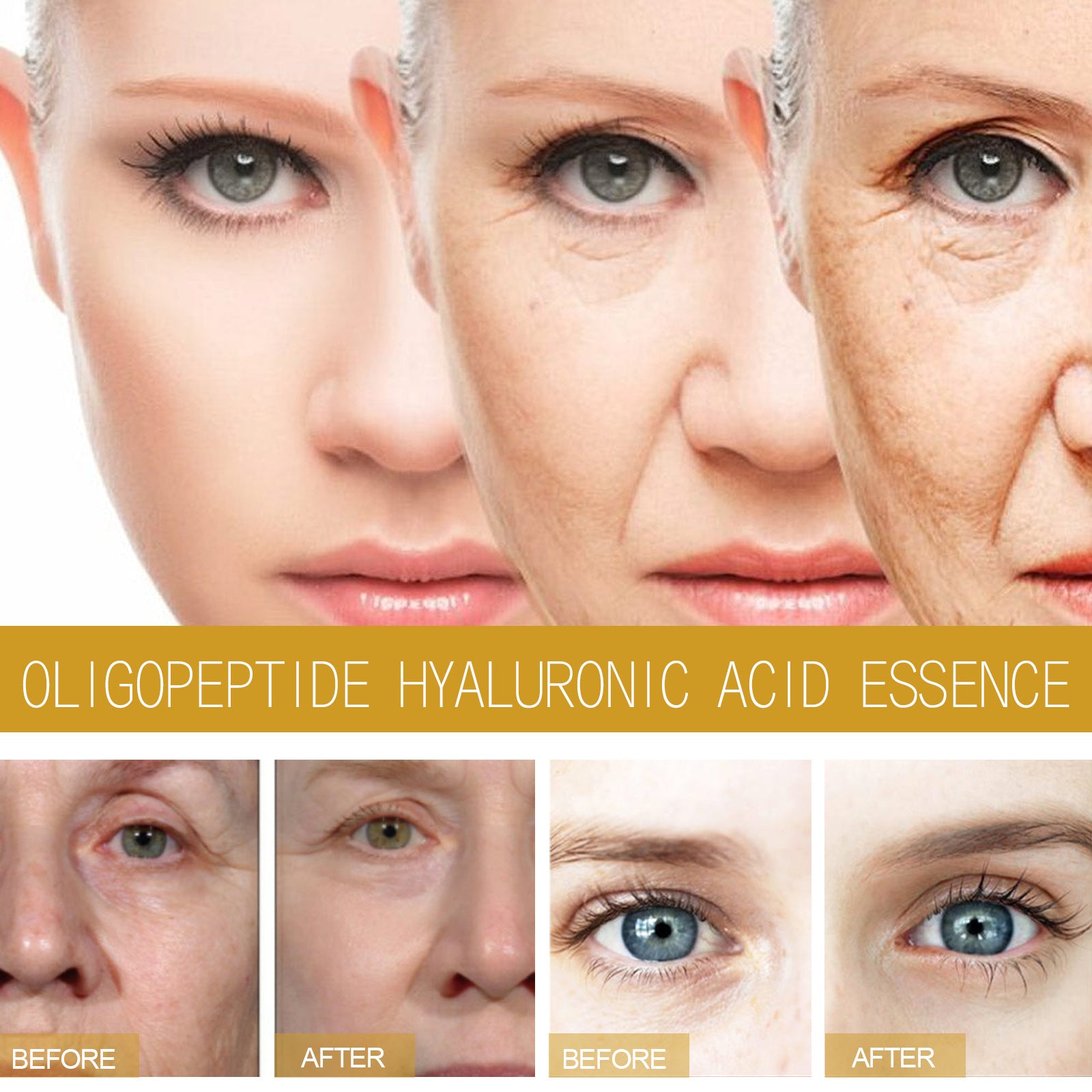 EELHOE Collagen Facial Skin Fading & Rejuvenation Wrinkle Treatment – Restore Youthful Radiance EELHOE COSMETICS