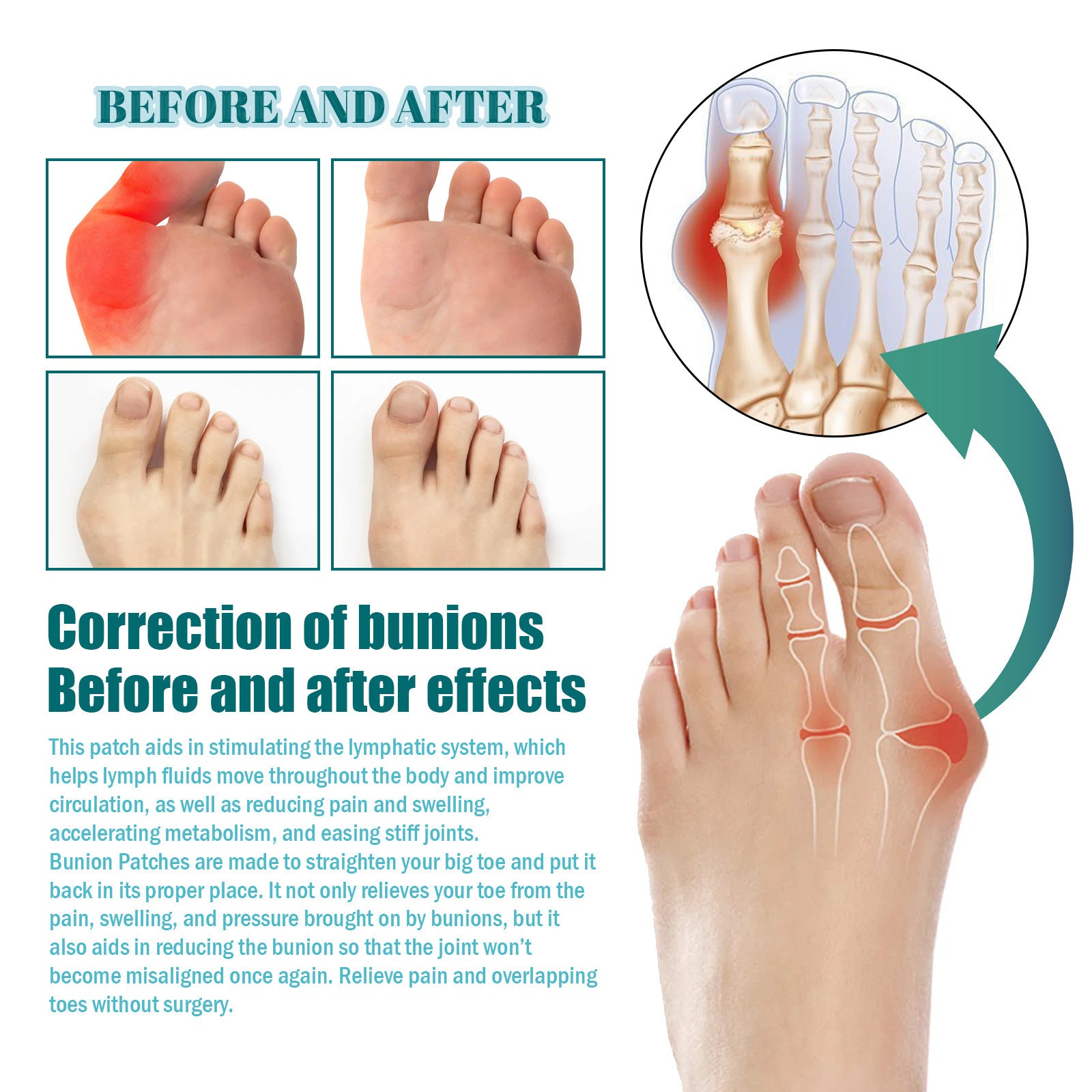 EELHOE Bunion Patch Relieve Foot Toe Swelling Pain Patch EELHOE COSMETICS