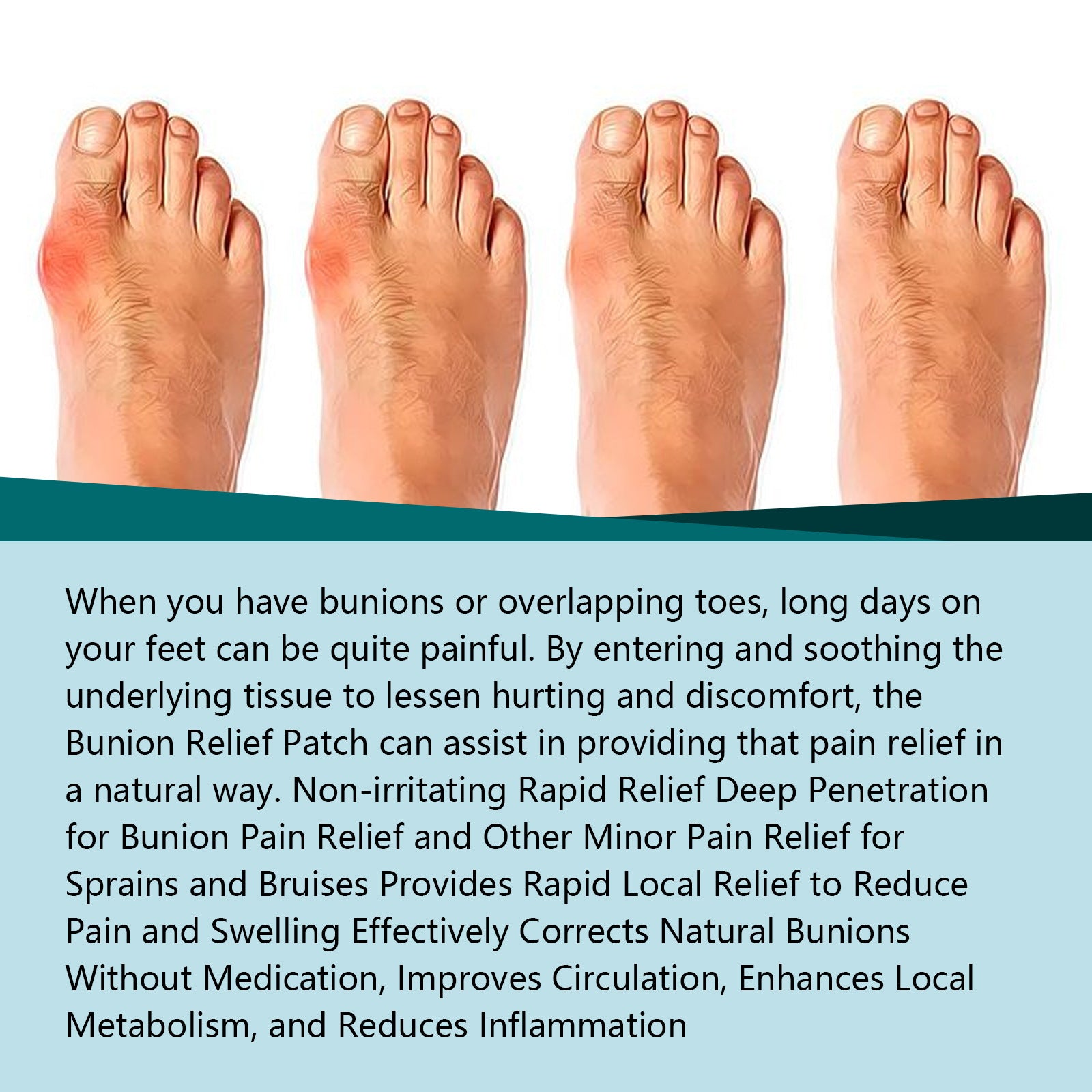 EELHOE Bunion Patch Relieve Foot Toe Swelling Pain Patch EELHOE COSMETICS