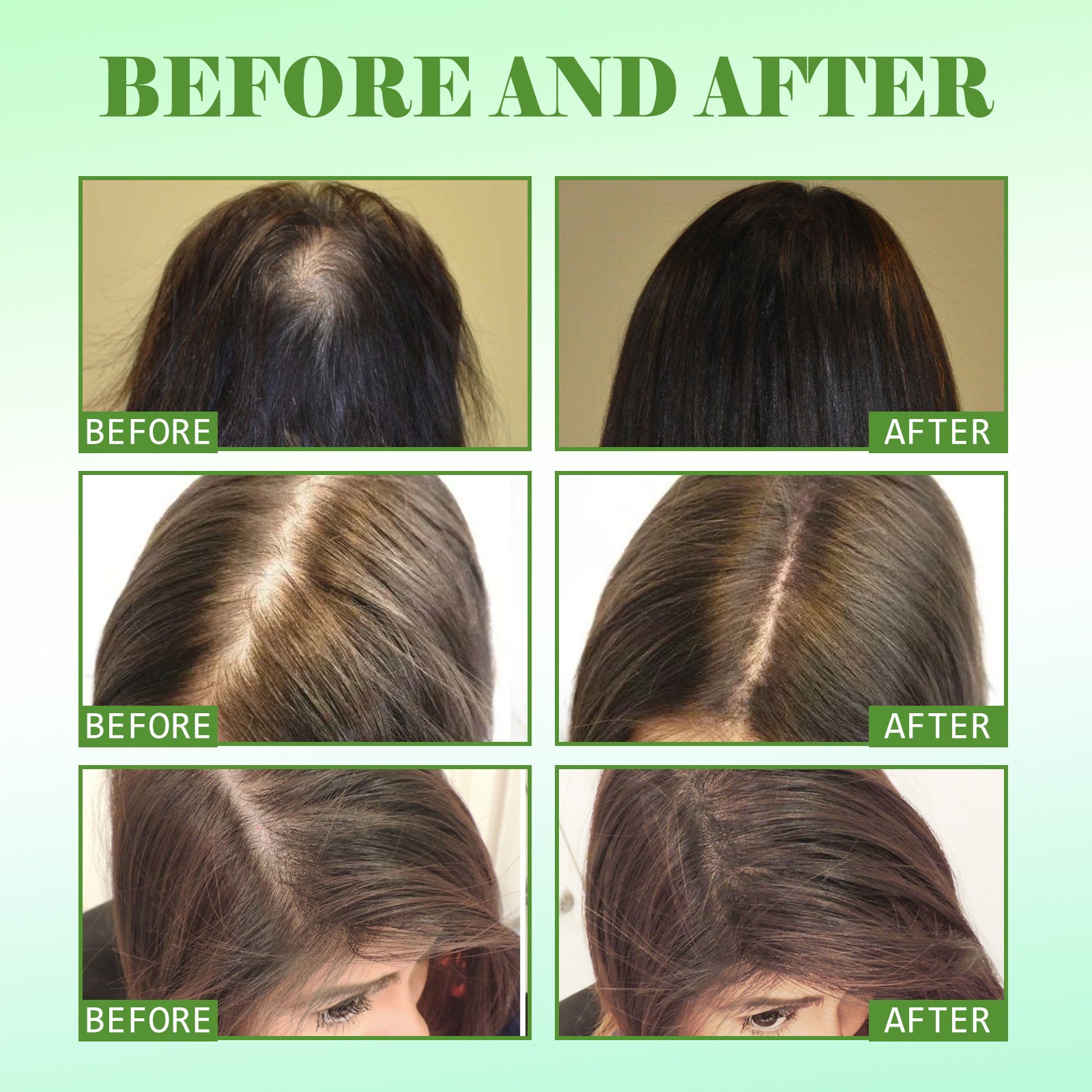 EELHOE Rosemary Oil Baby Hair Growth Essential Oil Repair & Damage Hair EELHOE COSMETICS