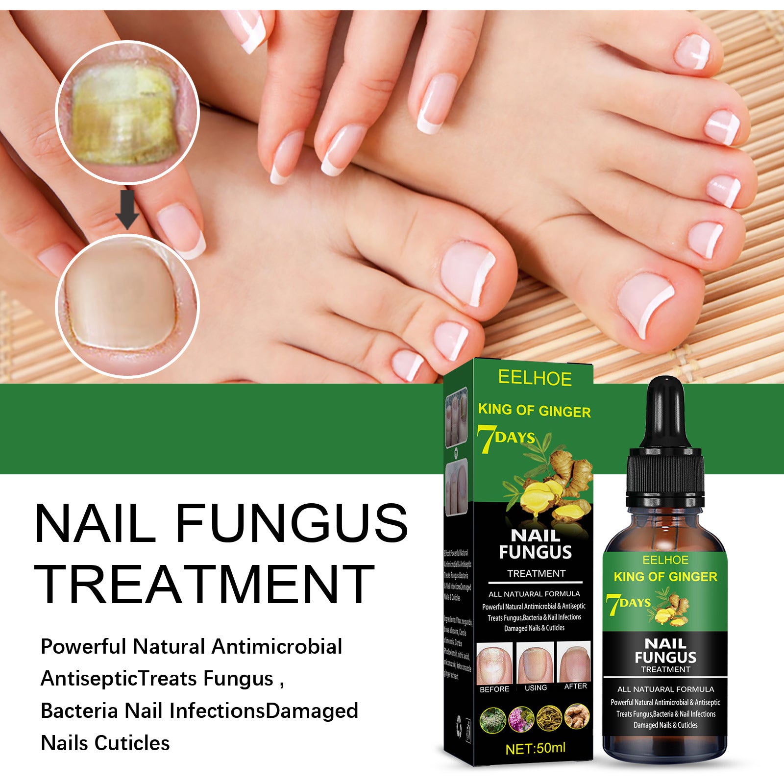 Eelhoe Nail Fungus Treatment Repair Solution – Effective Care for Hands, Feet, and Nails EELHOE COSMETICS