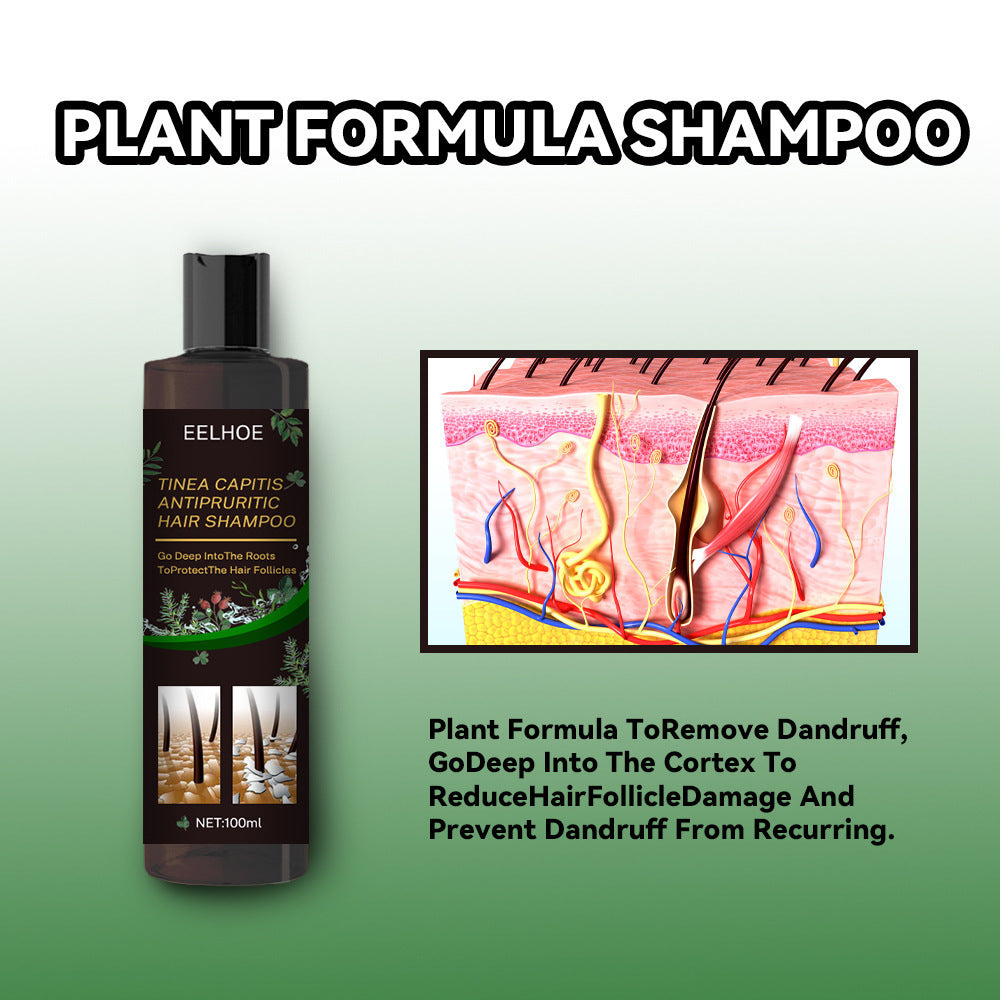 EELHOE Oil Control Anti-Itching Shampoo – Deep Cleaning & Scalp Care