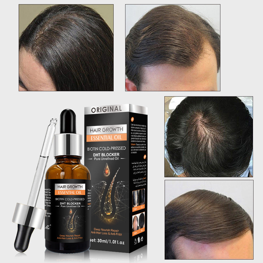 EELHOE Clean Dandruff Ginger Hair growth Shampoo 250ml EELHOE COSMETICS