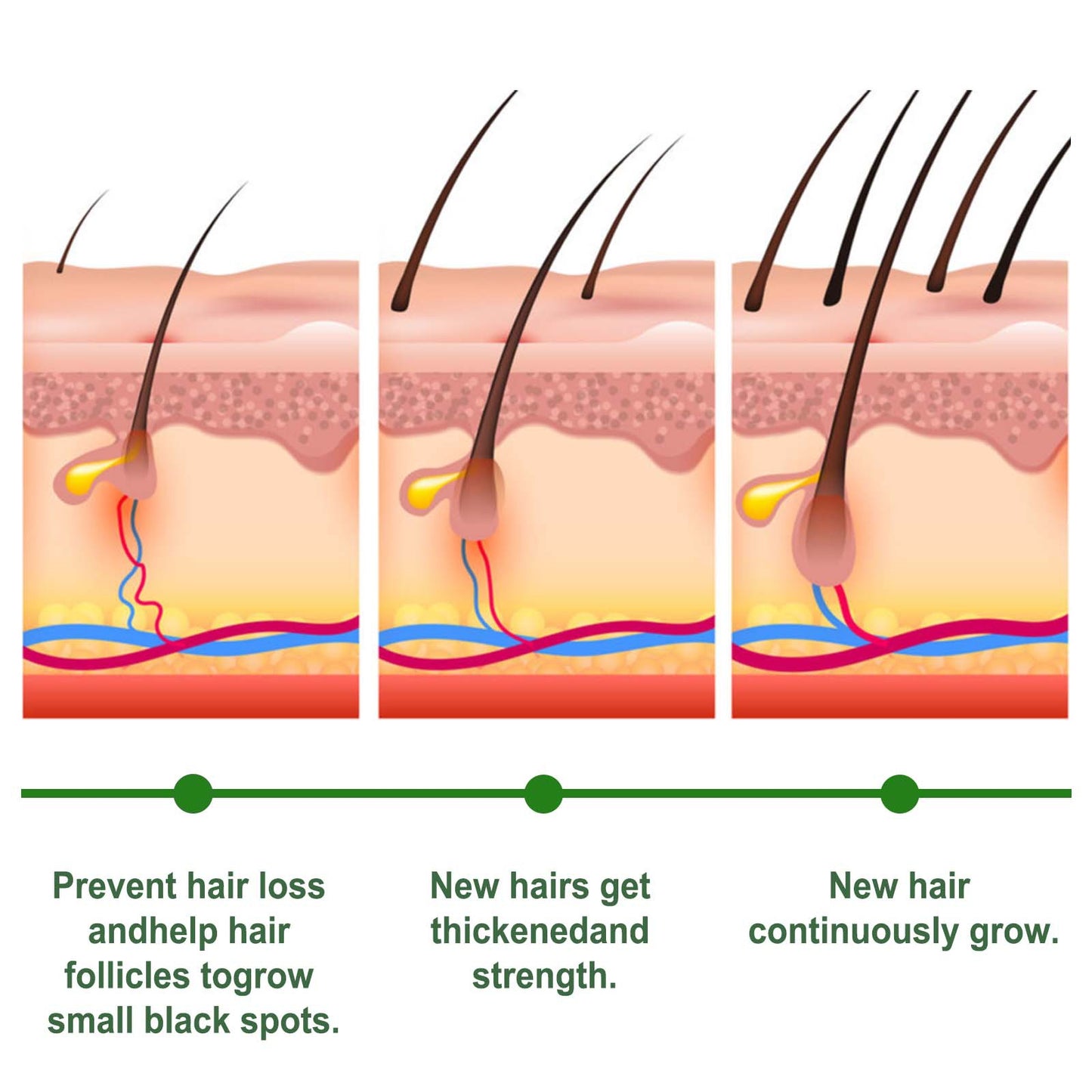 EELHOE Rosemary Hair Care Capsules – Nourish Hair Roots & Help Prevent Hair Loss EELHOE COSMETICS