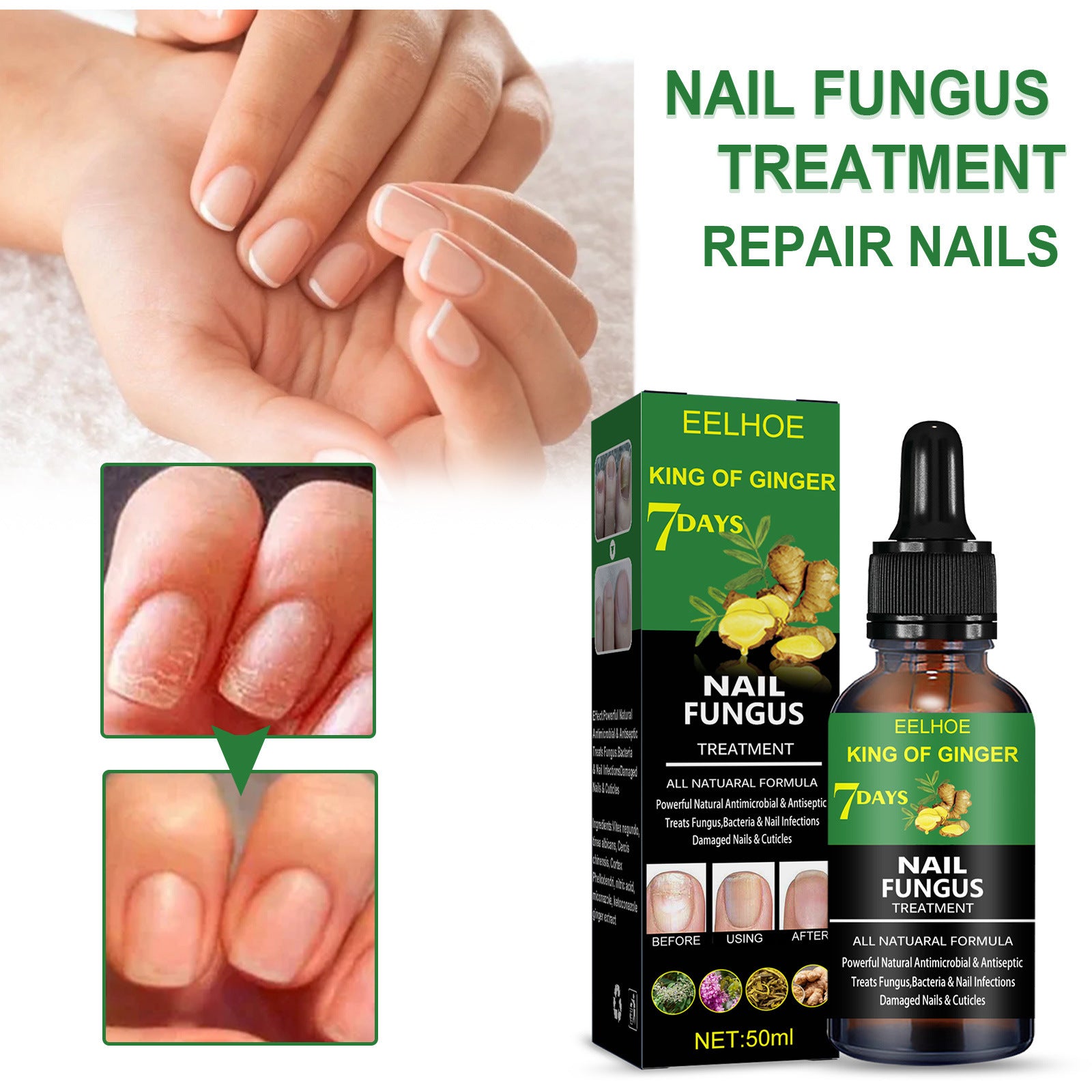 Eelhoe Nail Fungus Treatment Repair Solution – Effective Care for Hands, Feet, and Nails EELHOE COSMETICS