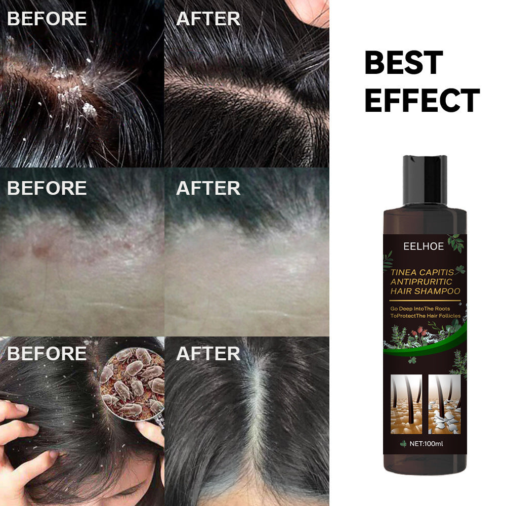 EELHOE Oil Control Anti-Itching Shampoo – Deep Cleaning & Scalp Care
