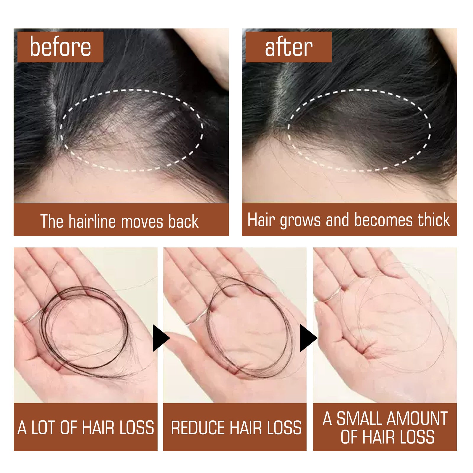 EELHOE Batana Oil Hair Conditioner Moisturizing Hair Root Strengthening And Anti-fall EELHOE COSMETICS