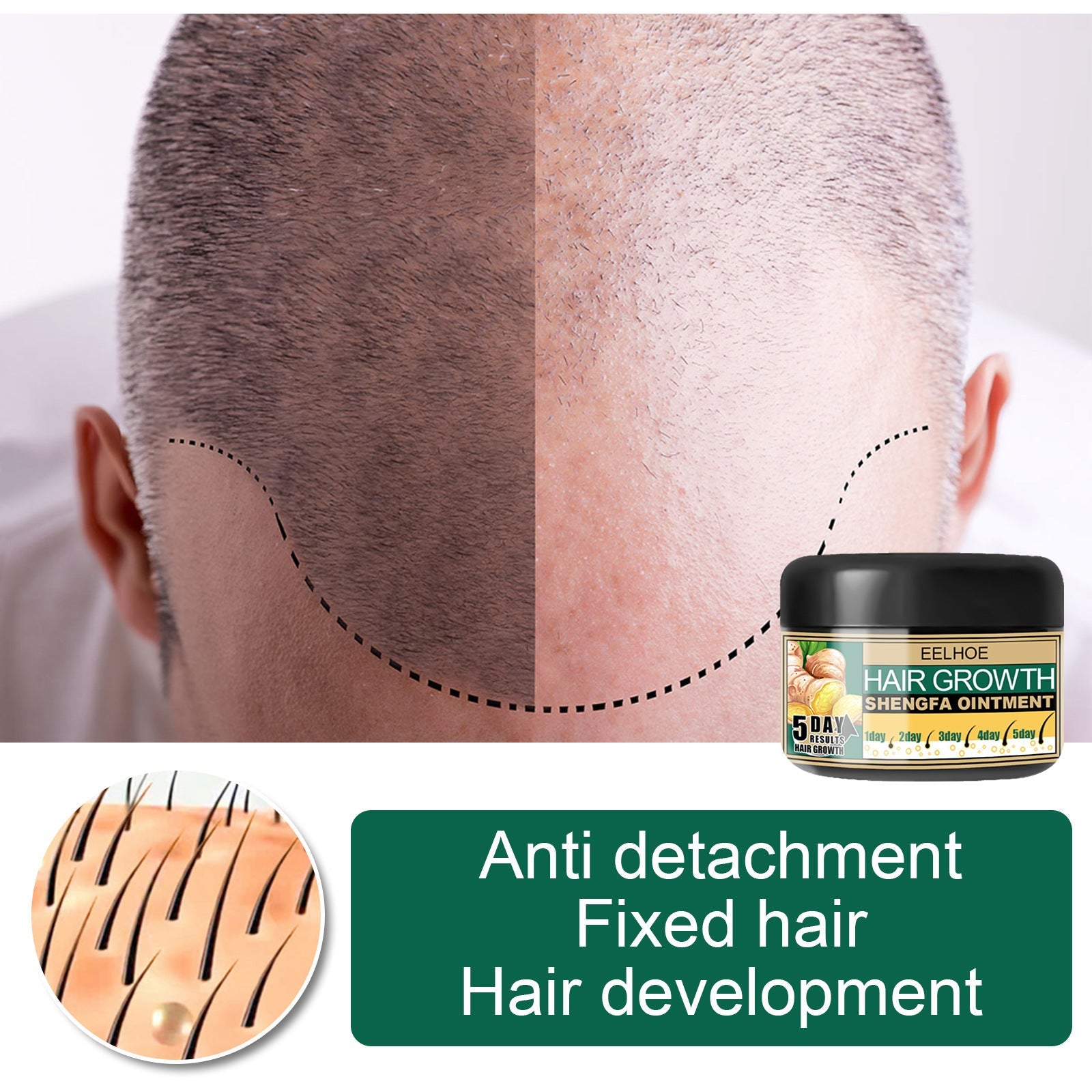 EELHOE Ginger Hair Growth Cream Antidandruff & Antipruritic Balm with collagen 30g EELHOE COSMETICS