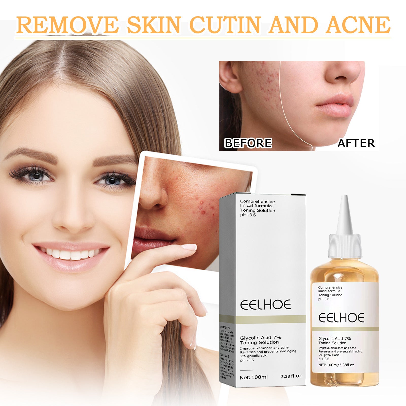 EELHOE Glycolic Acid 7% Toning Lotion Remove skin cutin & acne EELHOE Glycolic Acid 7% Toning Lotion Remove skin cutin & acne