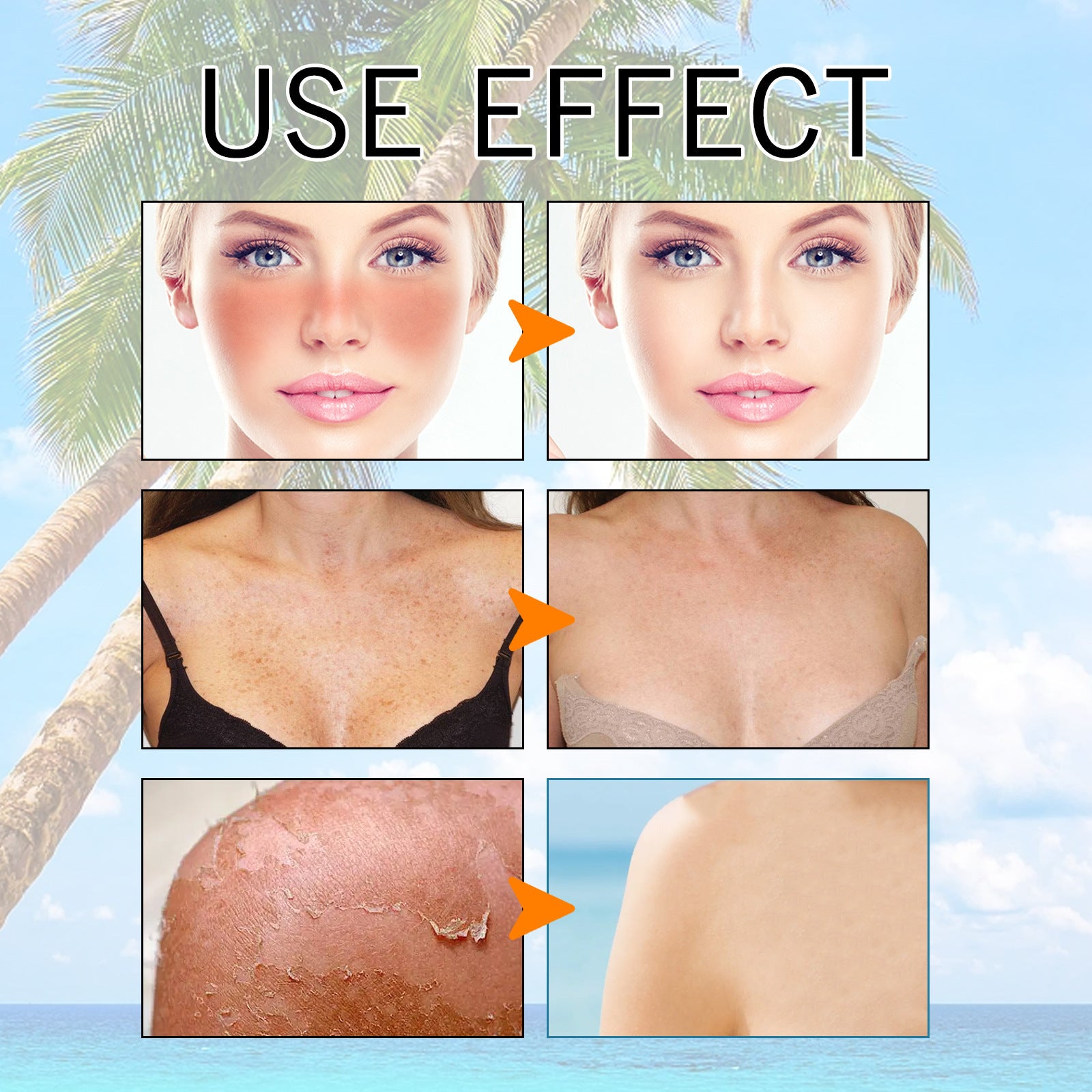 EELHOE Hyaluronic Acid Moisturizing Protective Gel Summer Outdoor Moisturizing Refreshing Not Oily Resist Ultraviolet Rays EELHOE COSMETICS