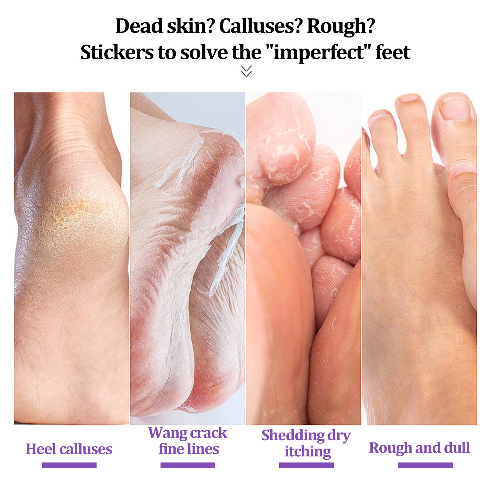 EELHOE Mask Foot Skin Chapped Exfoliating Skin Moisturizing And Nourishing Foot EELHOE COSMETICS