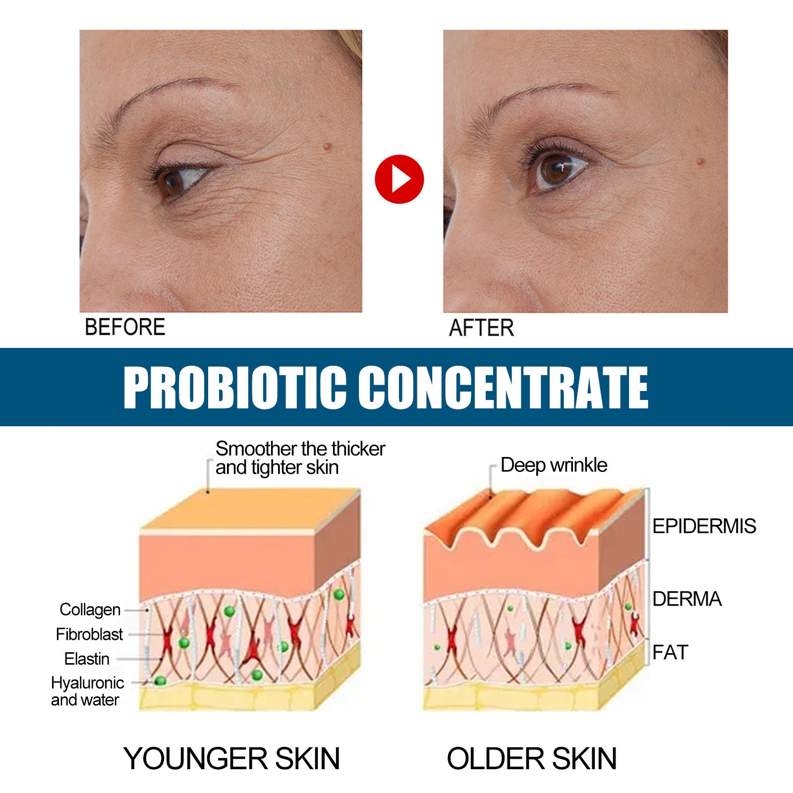 EELHOE Probiotics Concentrated Anti-wrinkle Serum Hydrating And Firming EELHOE COSMETICS