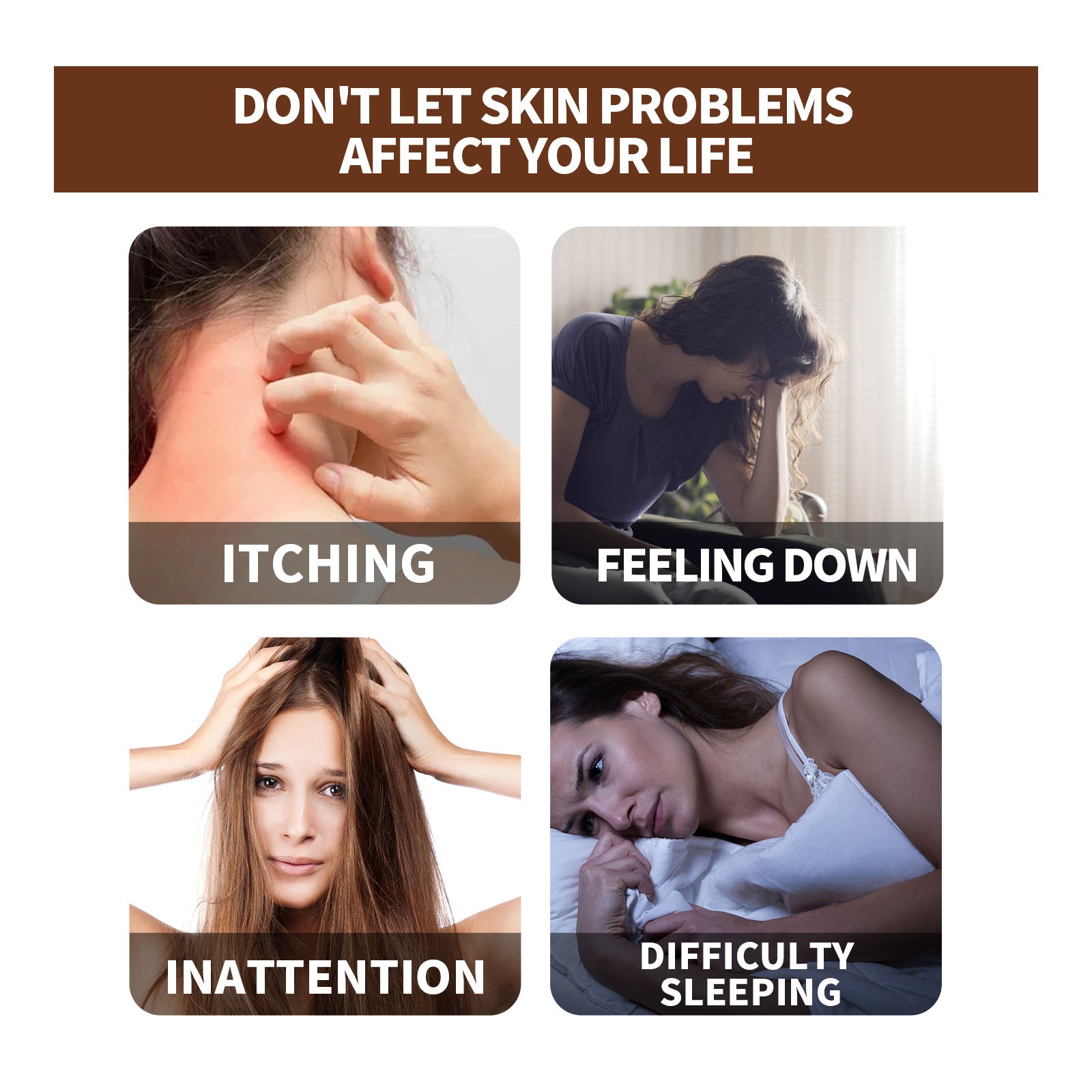 EELHOE Exczema and Psoriasis Cure Skin Moss Repair Essential Oil Relieves Itching EELHOE COSMETICS