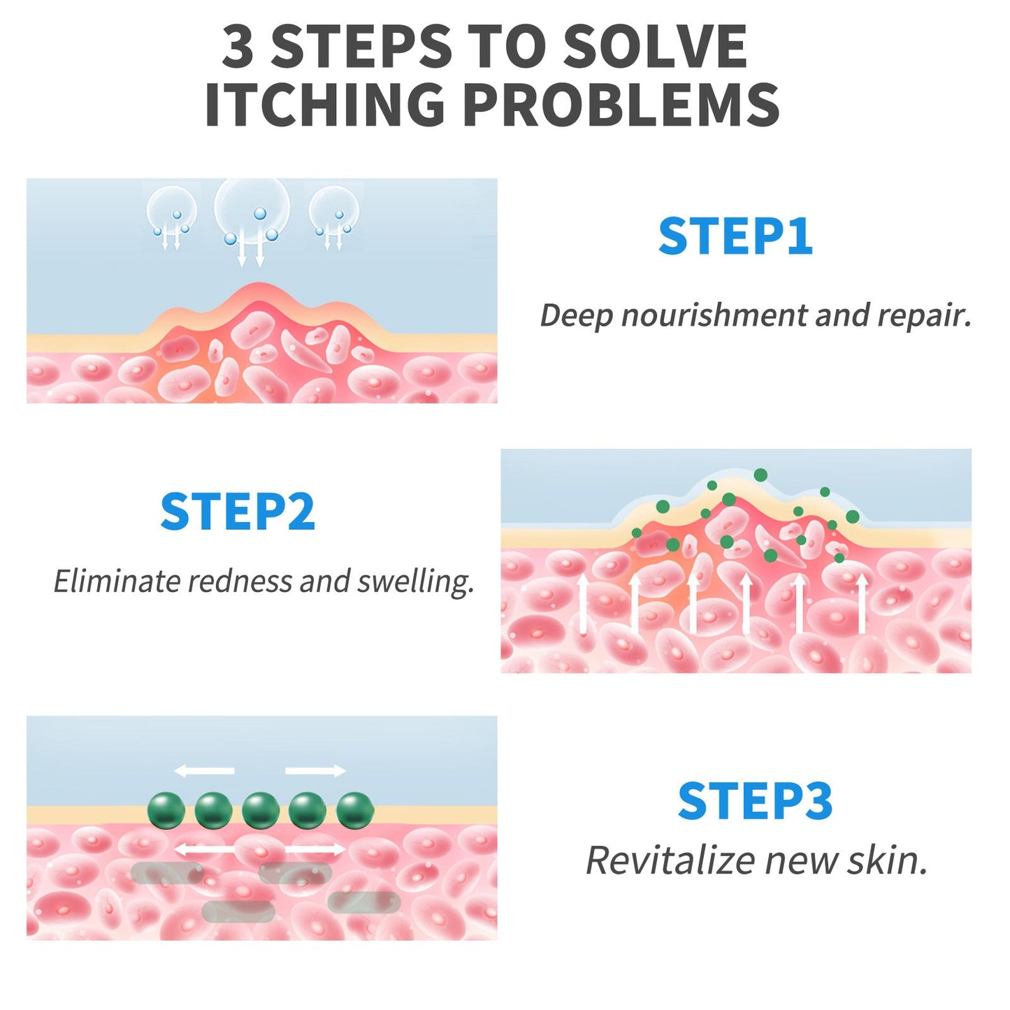 EELHOE Exczema and Psoriasis Cure Skin Moss Repair Essential Oil Relieves Itching EELHOE COSMETICS