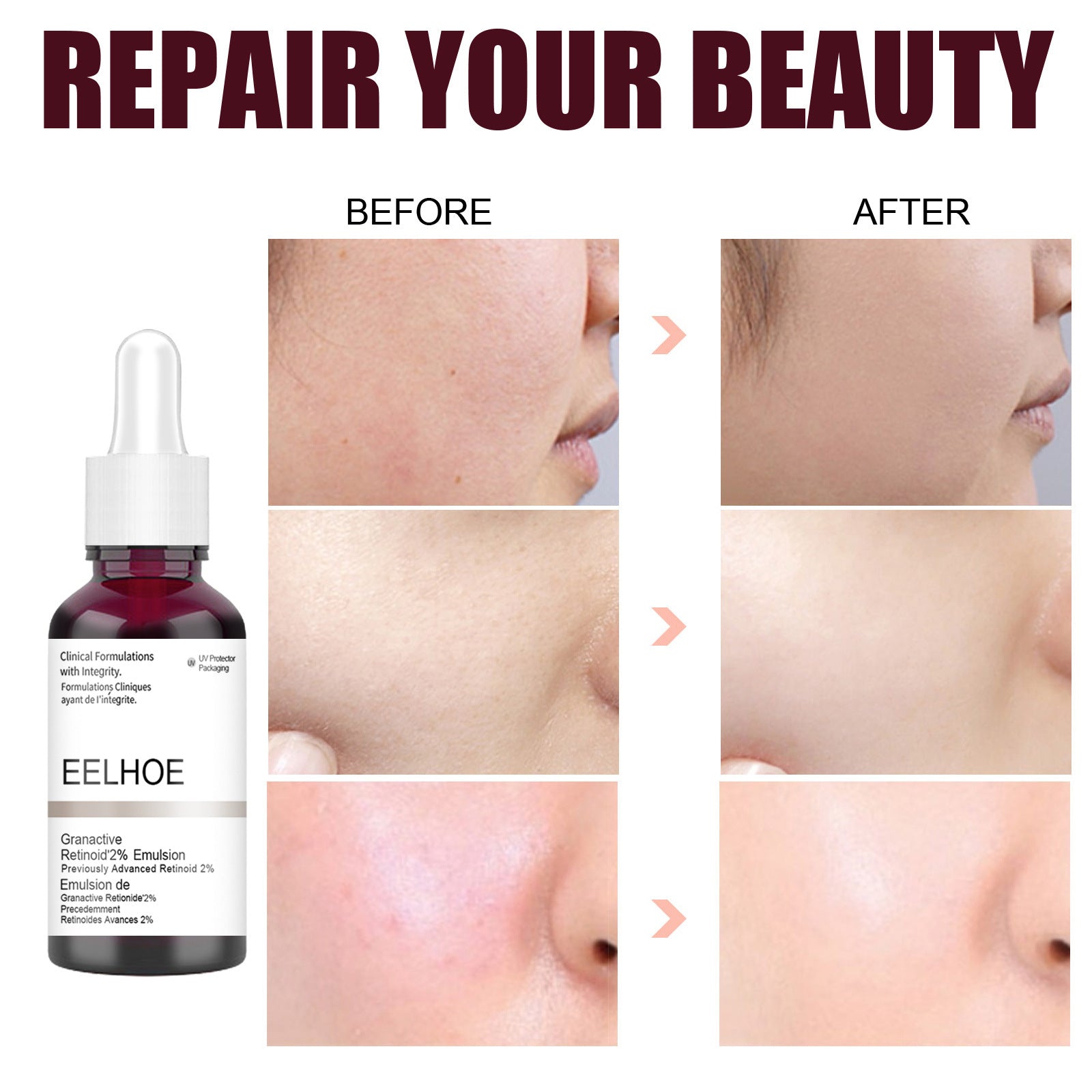 EELHOE Salicylic Acid for skin Serum Pore Refining Serum Retinoid 2% EELHOE COSMETICS