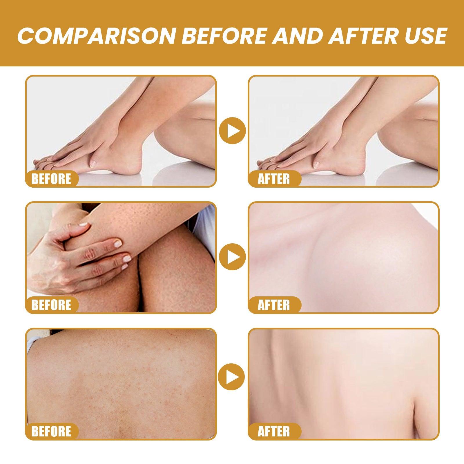 EELHOE Turmeric Body Scrub Rejuvenation Cleansing Skin EELHOE COSMETICS