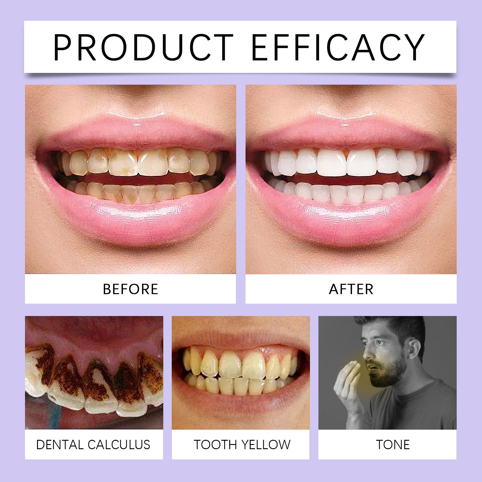EELHOE Purple Toothpaste – Gentle Care for a Bright, Healthy Smile EELHOE COSMETICS