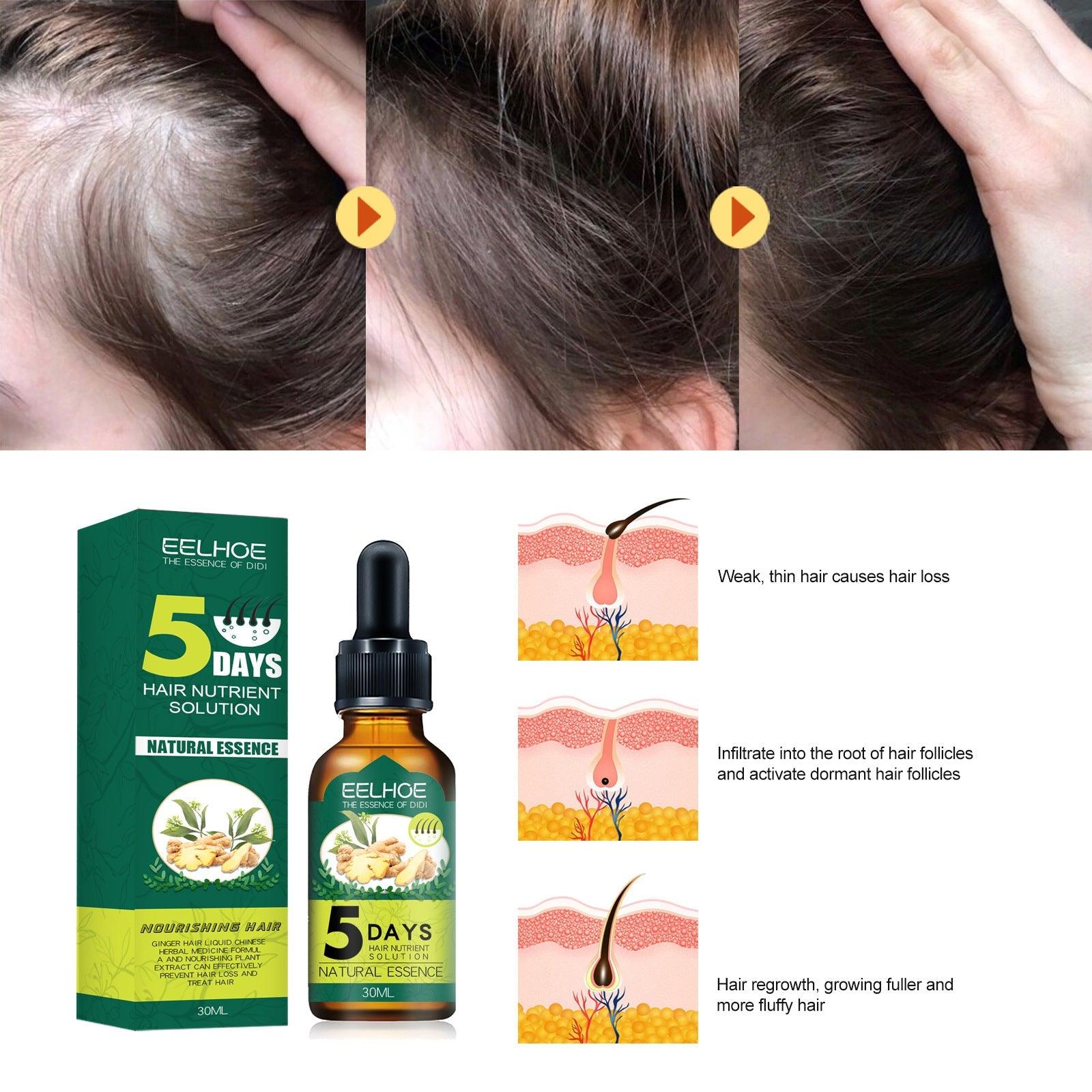 EELHOE Hair oil regrowth Ginger Essential Oil for Alopecia and Hair Loss (30ml)