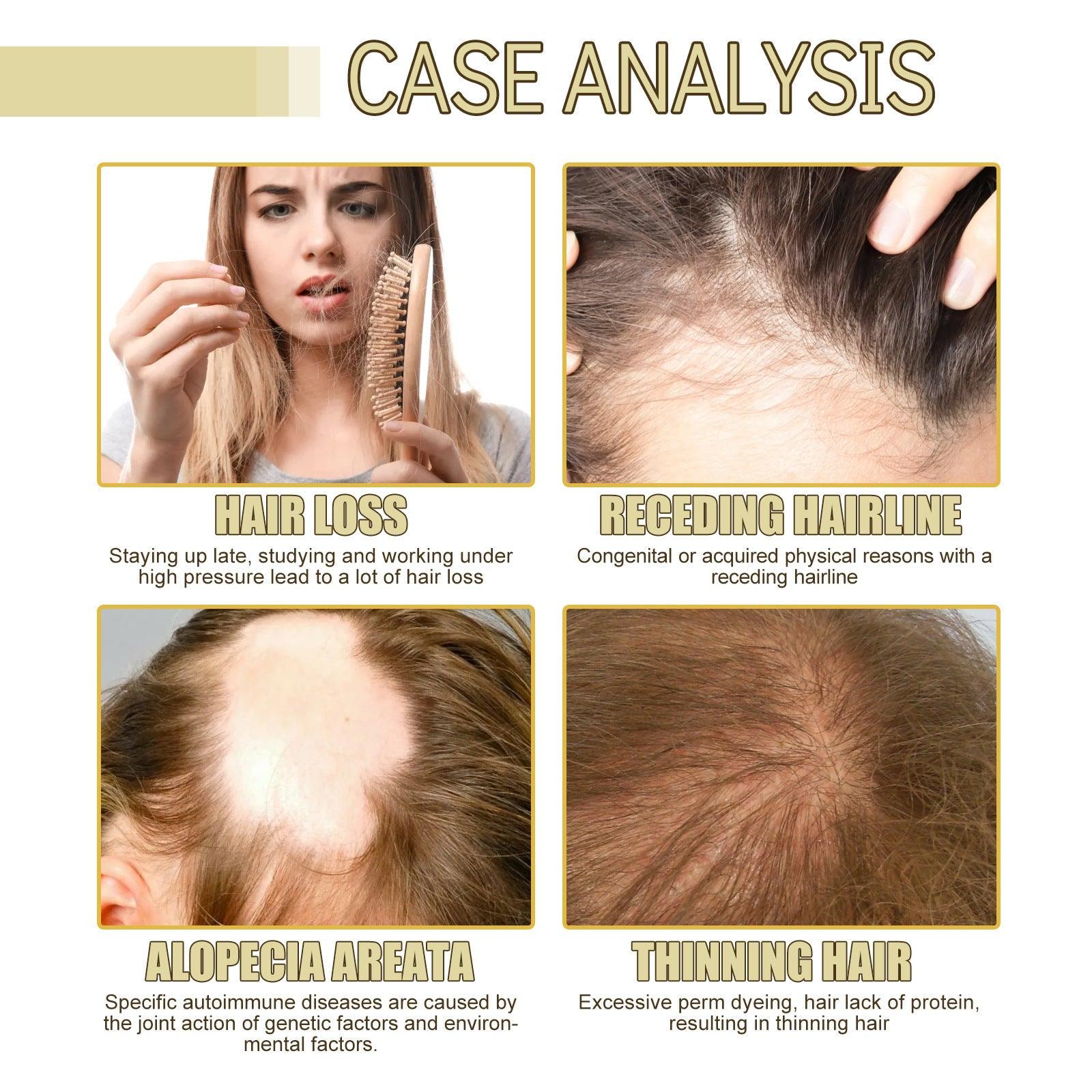 EELHOE Natural essential oil for hair growth nourishing with rosemary EELHOE COSMETICS