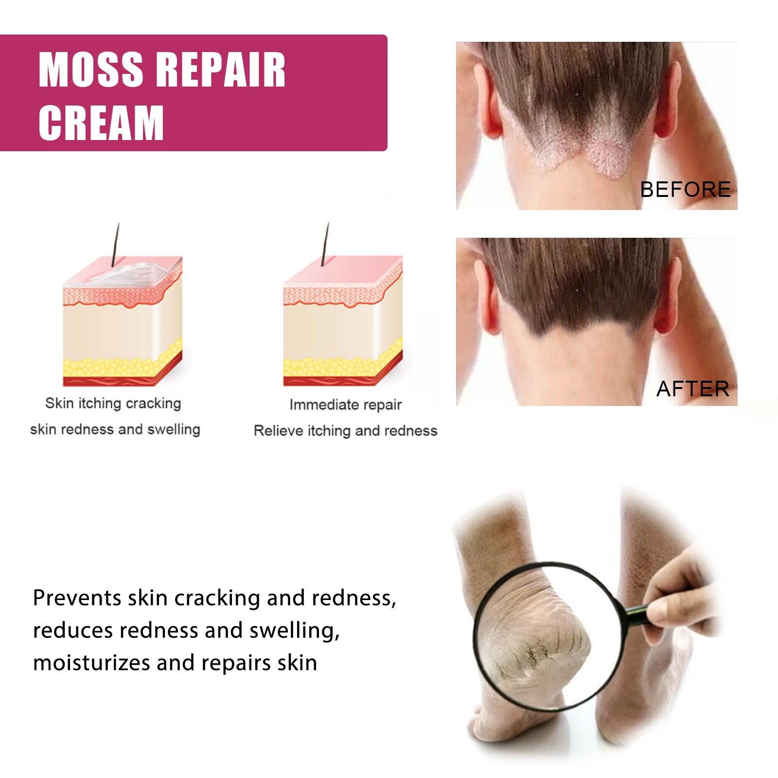 EELHOE Repair Cream Relieve Itching Body , Hands And Feet 50g EELHOE COSMETICS