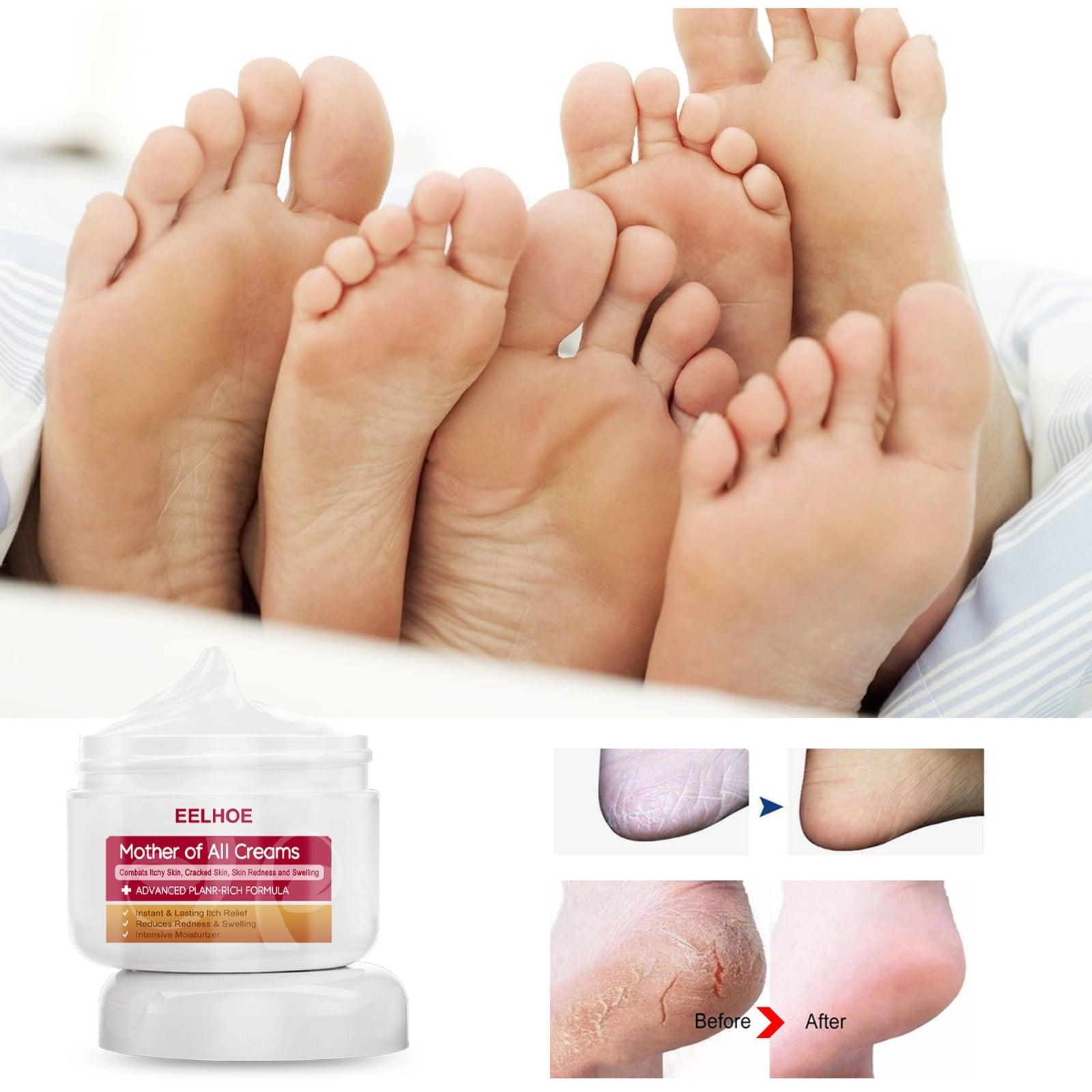 EELHOE Repair Cream Relieve Itching Body , Hands And Feet 50g EELHOE COSMETICS
