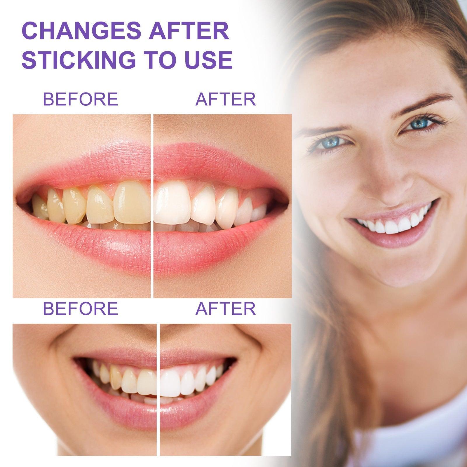 EELHOE Whitening Toothpaste V34 EELHOE COSMETICS