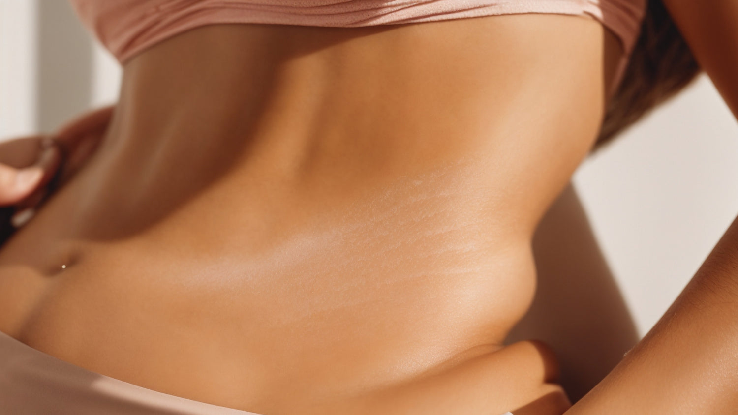 Can Scar Cream Remove Stretch Marks?