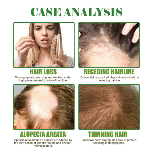 Unlocking Your Hair's True Potential: The Indispensable Role of Hair Growth Oils in Achieving Peak Health and Vibrancy