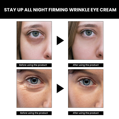 EELHOE Dark Circles Eye Cream – Fade Wrinkles, Eye Bags & Dark Circles EELHOE COSMETICS