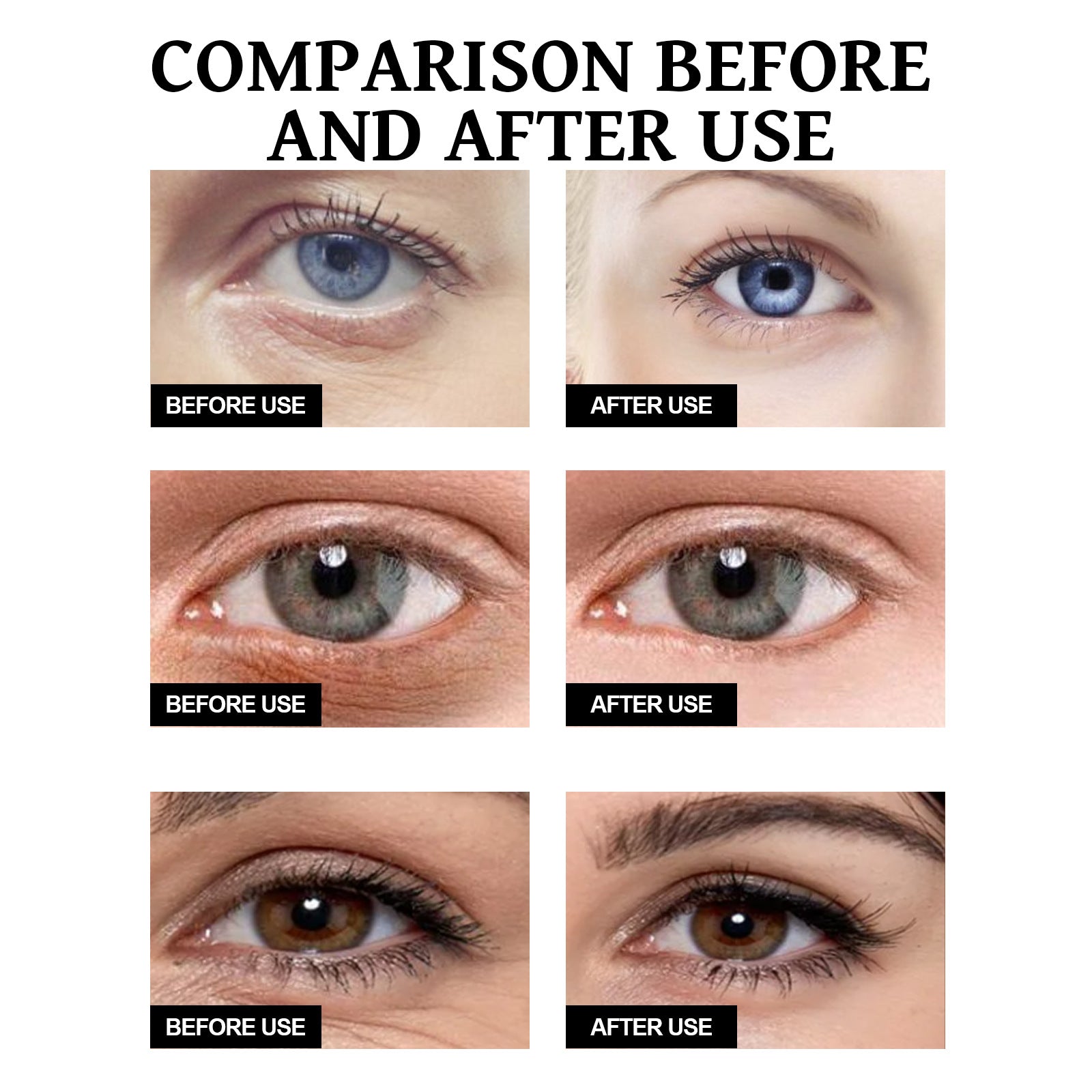 EELHOE Dark Circles Eye Cream – Fade Wrinkles, Eye Bags & Dark Circles EELHOE COSMETICS