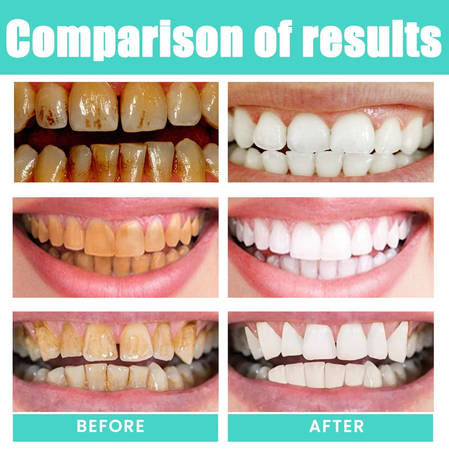 EELHOE Coconut Mint Mouthwash – Teeth Whitening & Fresh Breath EELHOE COSMETICS