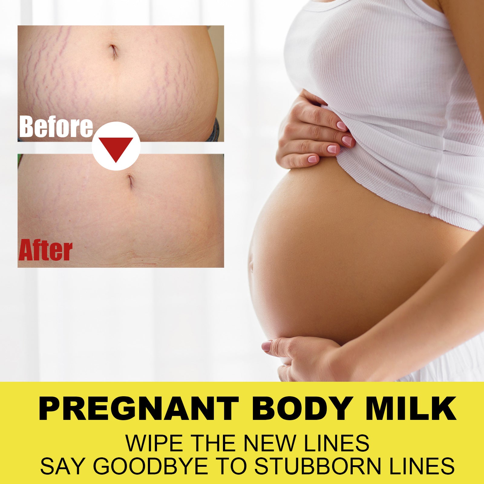 Eelhoe Total Erase Stretch Marks Obesity & Pregnancy Repair CreamEELHOE Total Erase Stretch Marks Cream – Pregnancy & Weight Repair Care EELHOE COSMETICS