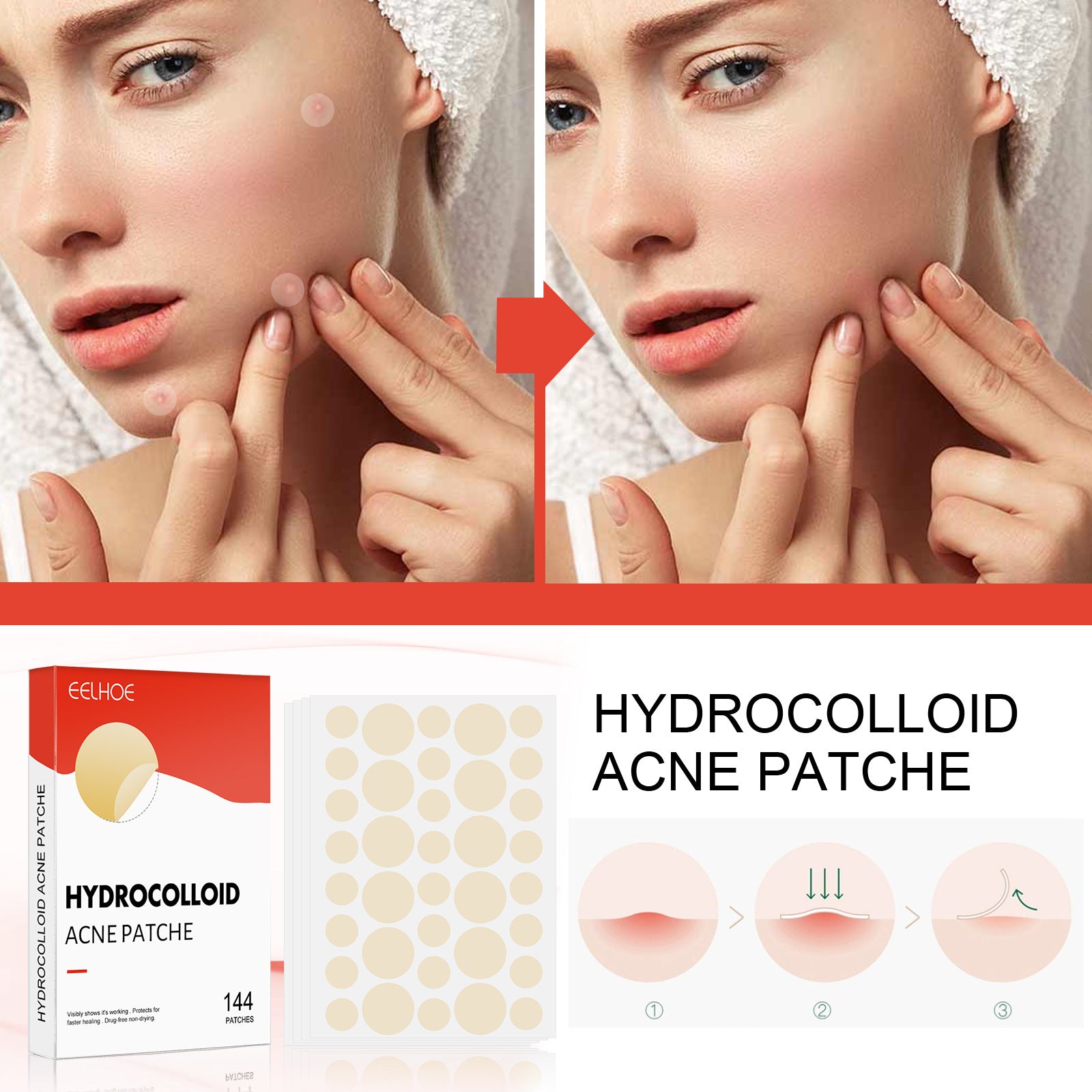 Eelhoe Patch Invisible Hydrocolloid  Anti Acne for Makeup 