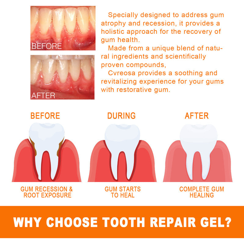 EELHOE Teeth Repair & Deep Cleaning – Whitening & Gum Care Solution EELHOE COSMETICS