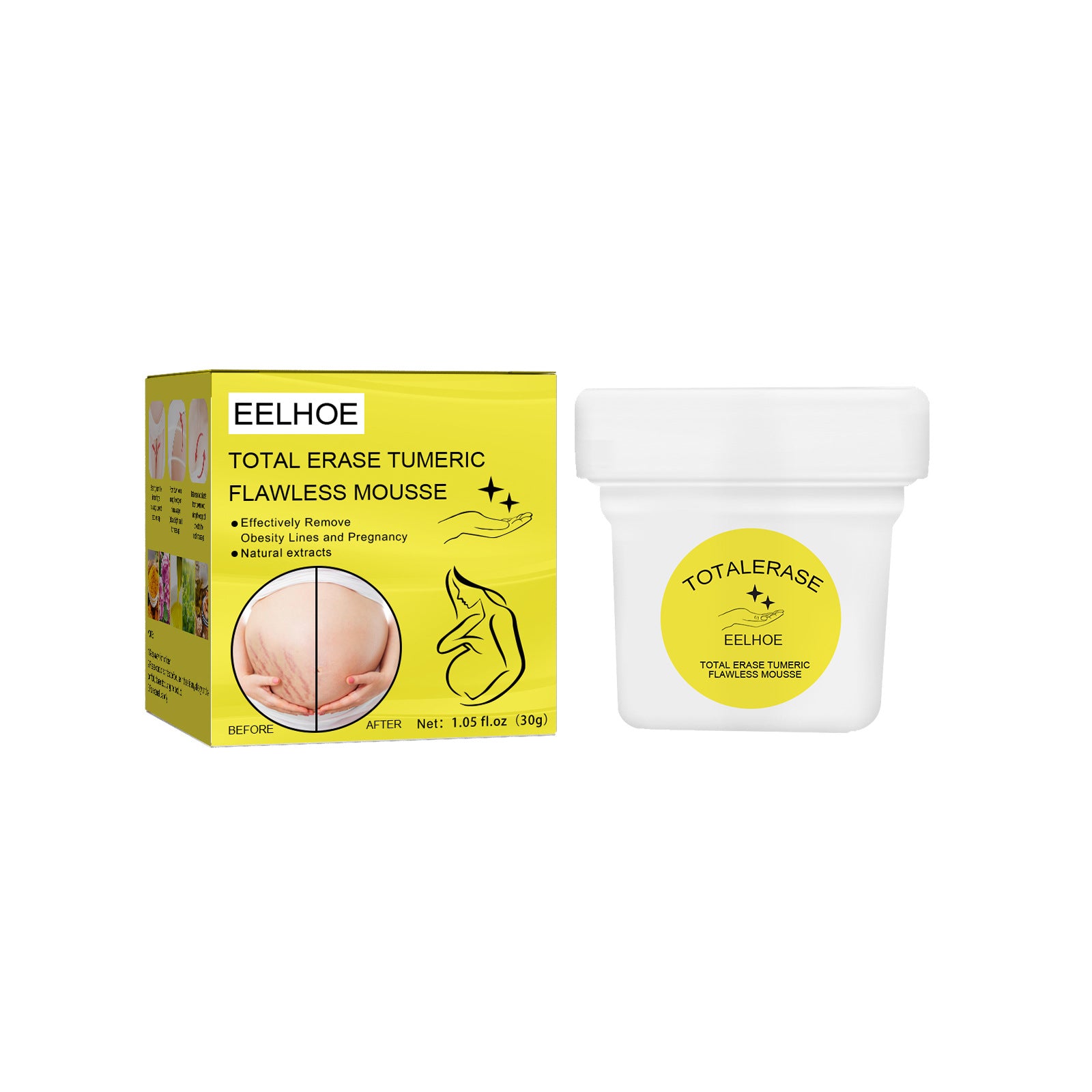 Eelhoe Total Erase Stretch Marks Obesity & Pregnancy Repair CreamEELHOE Total Erase Stretch Marks Cream – Pregnancy & Weight Repair Care 30g Boxed EELHOE COSMETICS