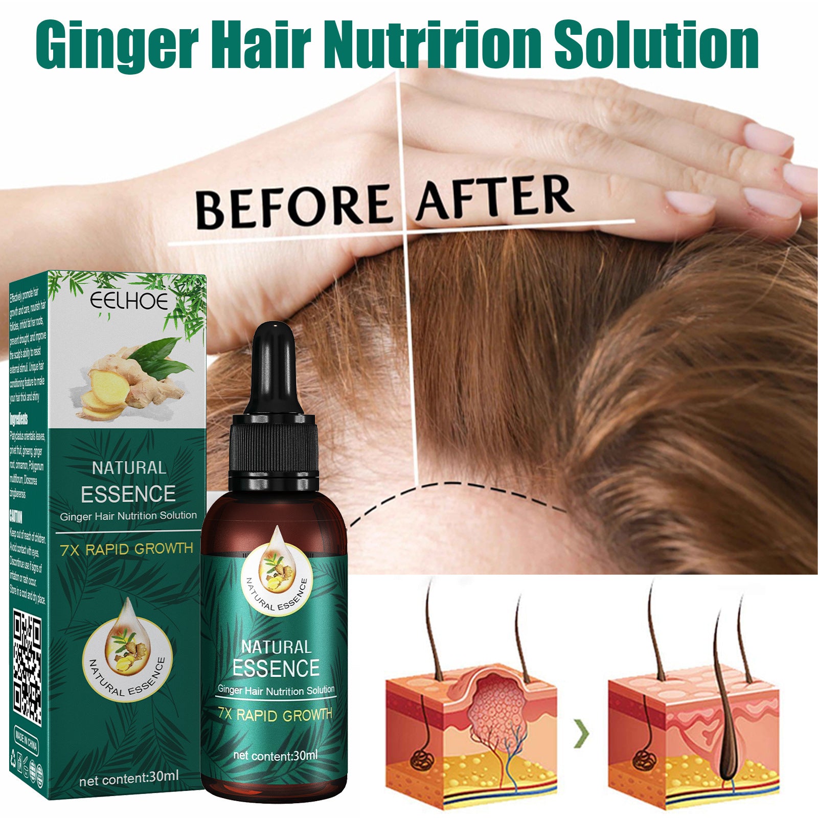 EELHOE Ginger Up Regrow &amp; Repair Hair Nutrition Hair Care Essential Oil