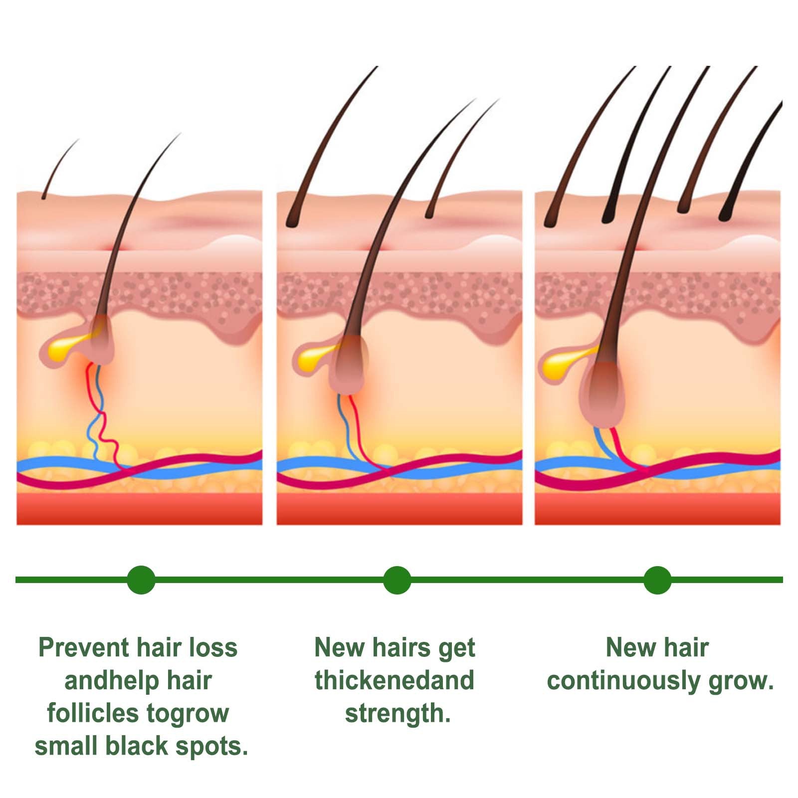 EELHOE Rosemary Hair Care Capsules – Nourish Hair Roots & Help Prevent Hair Loss EELHOE COSMETICS