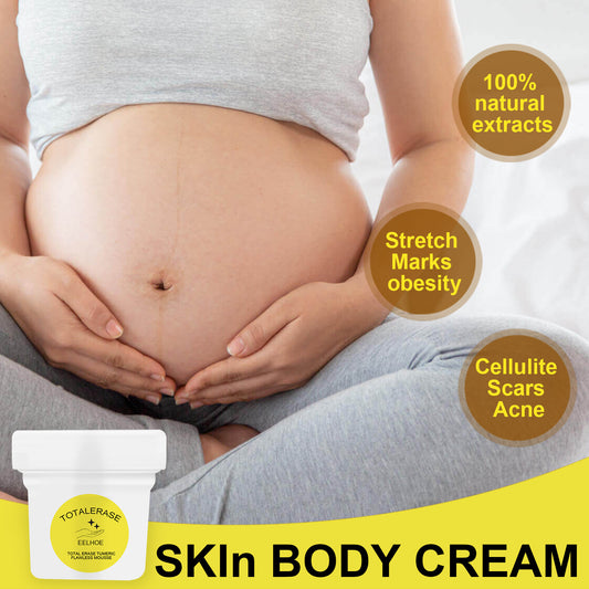 Eelhoe Total Erase Stretch Marks Obesity & Pregnancy Repair CreamEELHOE Total Erase Stretch Marks Cream – Pregnancy & Weight Repair Care EELHOE COSMETICS