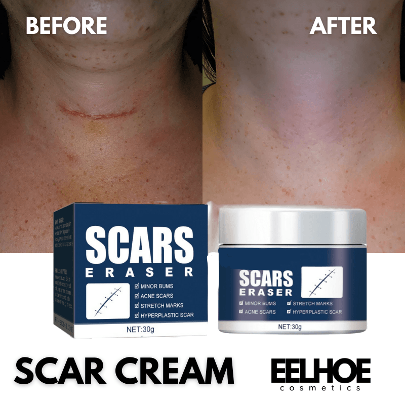 Scar Removal Cream 12 WEEKS Remove Scars Effectively Treat Skin Surgery Scars Stretch Marks Acne Burn Scars Facial Gel

