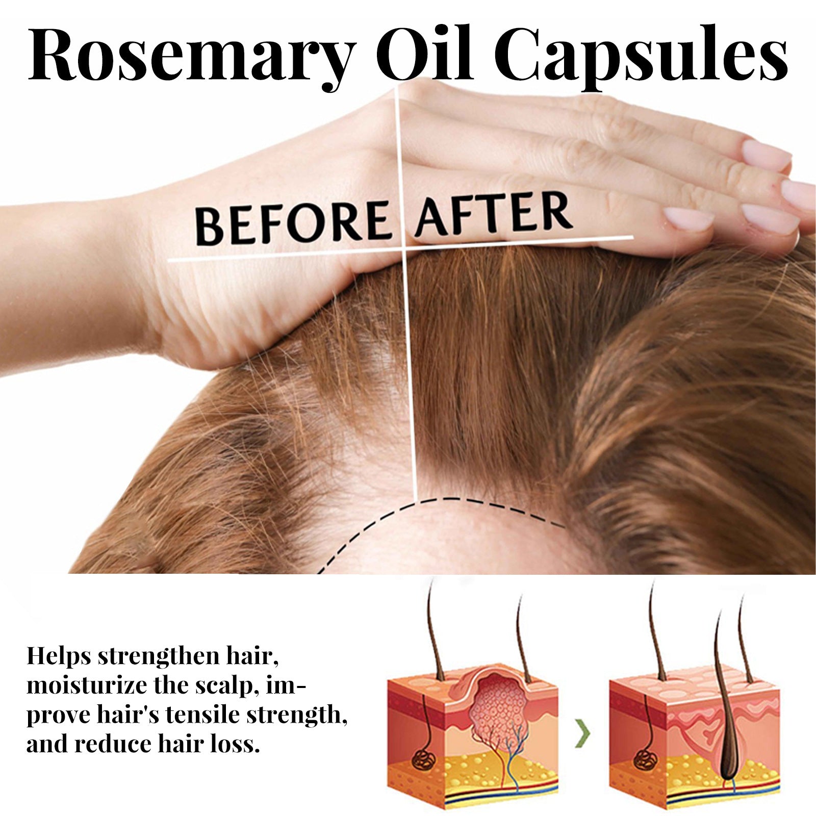 EELHOE Rosemary Hair Care Capsules – Nourish Hair Roots & Help Prevent Hair Loss EELHOE COSMETICS
