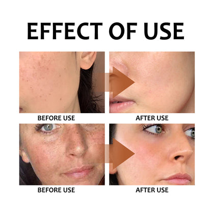 EELHOE Lemon Turmeric Kojic Acid Soap – Brightening and Nourishing Skincare EELHOE COSMETICS