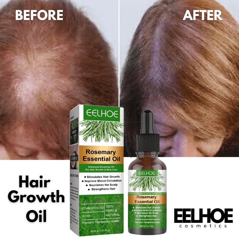 EELHOE Hair Growth + Anti-Breakage Rosemary Essential Oil Hair 30ML - EELHOE COSMETICS