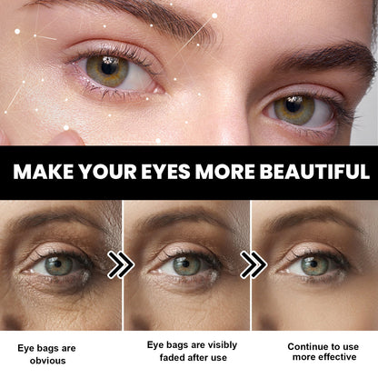 EELHOE Dark Circles Eye Cream – Fade Wrinkles, Eye Bags & Dark Circles EELHOE COSMETICS