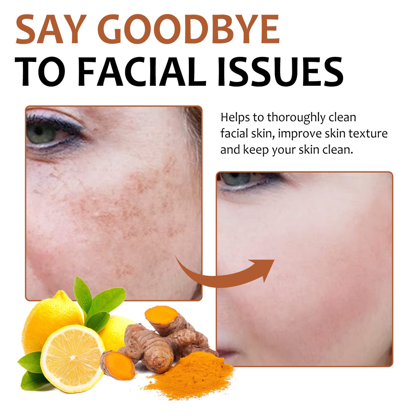 EELHOE Lemon Turmeric Kojic Acid Soap – Brightening and Nourishing Skincare EELHOE COSMETICS