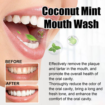 EELHOE Coconut Mint Mouthwash – Teeth Whitening & Fresh Breath EELHOE COSMETICS