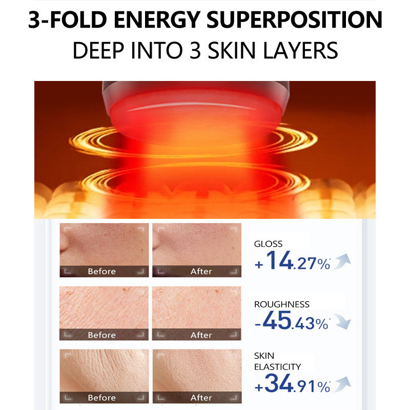 EELHOE Red-Light Thermal Therapy Rejuvenation Beauty Device
