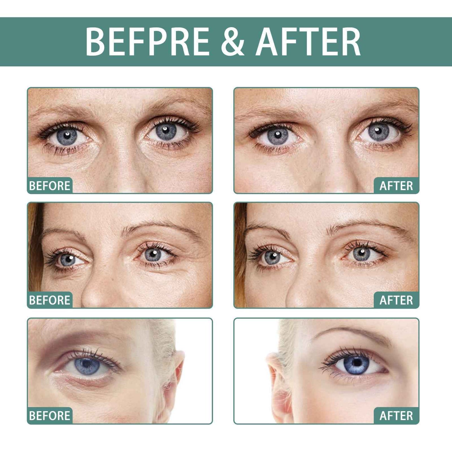 Anti-wrinkle Eye Cream Protects Skin Around Eyes And Reduces Dark Spots EELHOE COSMETICS