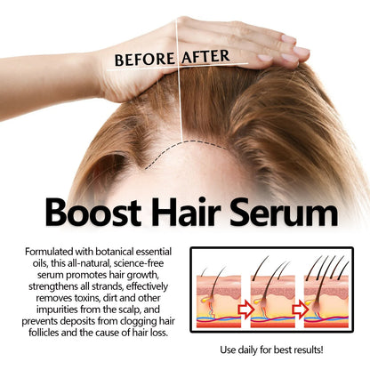 EELHOE Boost Hair Serum – Anti-Hair Loss & Strengthening Treatment EELHOE COSMETICS
