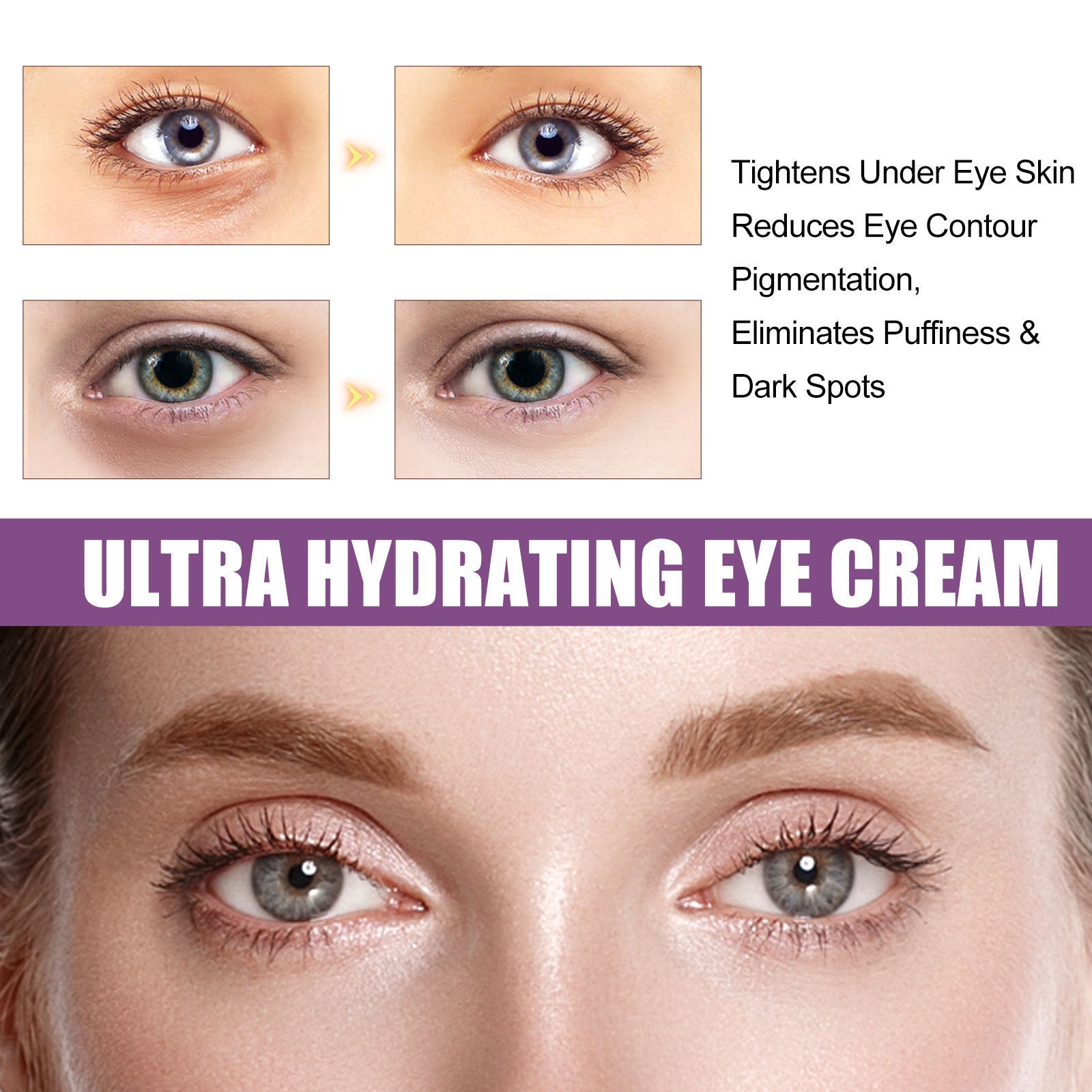 Moisturizing Eye Cream Lighten Eye Circumference Eye Bags And Dark Circle