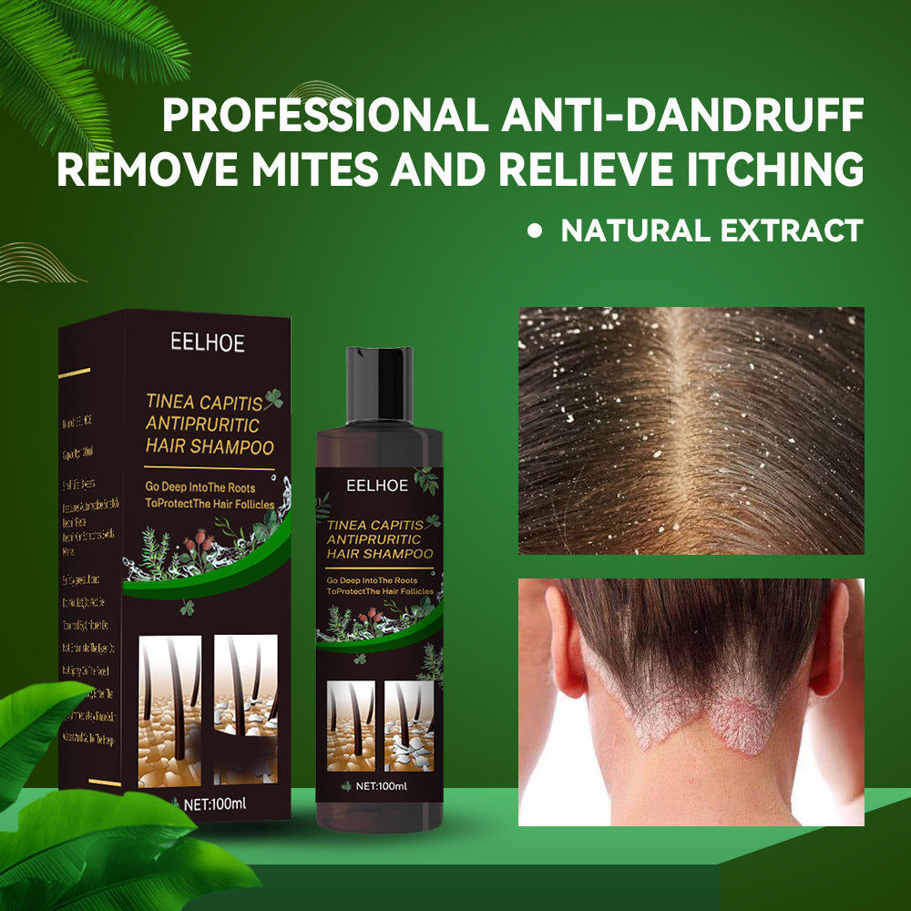 EELHOE Oil Control Anti-Itching Shampoo – Deep Cleaning & Scalp Care